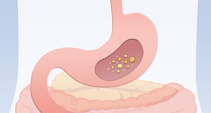 Diagram showing food traveling to the stomach