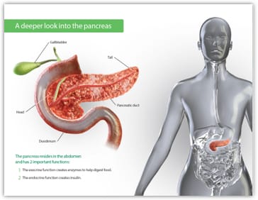 Image of Pancreas Model PDF